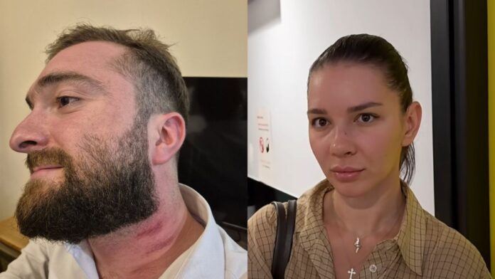 Georgian Man Arrested After Hitting Tourist Woman in Telavi Hotel Released on Bail - Civil Georgia