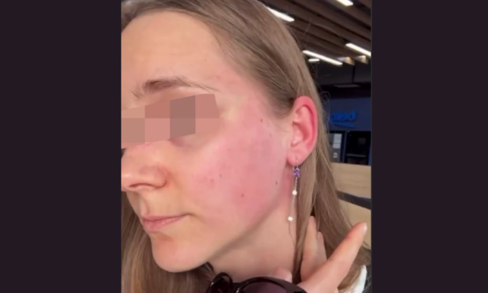 Man Arrested As Tourist From Belarus Alleges Attack Over Russian Speech in Tbilisi - Civil Georgia
